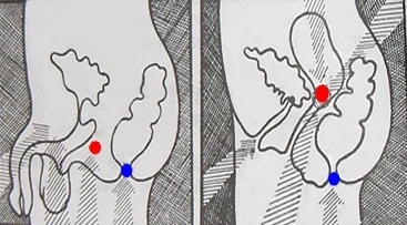 Мула бандха: техника выполнения корневого замка в практике йоги