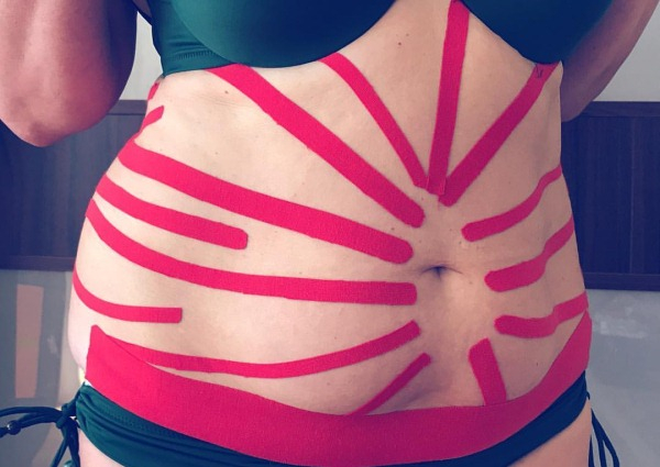 Тейпирование живота и боков для похудения. Схема, как делается, фото, результаты Тейпирование живота и боков для похудения. Схема, как делается, фото, результаты